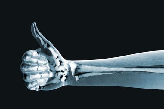 Rentgen může pomoci diagnostikovat bolest v kloubech prstů
