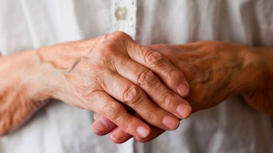 Revmatoidní artritida způsobuje bolest a otoky v kloubech prstů. 