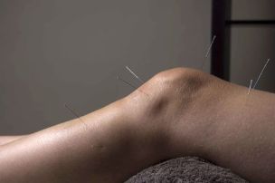 Akupunktura podporuje opravu kloubních tkání
